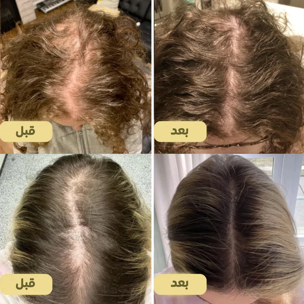 عرض فرشاة فرد شعر جوي 2 في 1 + زيت الشعر الطبيعي EELHOE